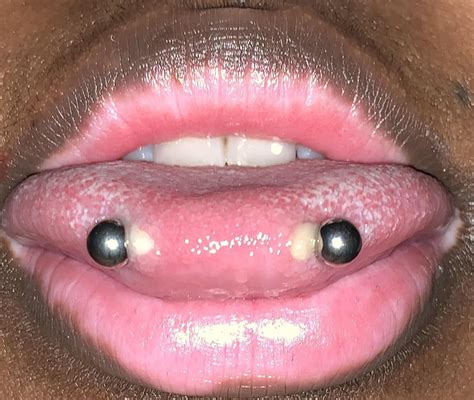 discharge from tongue piercing|3 Ways to Tell if a Piercing Is Infected